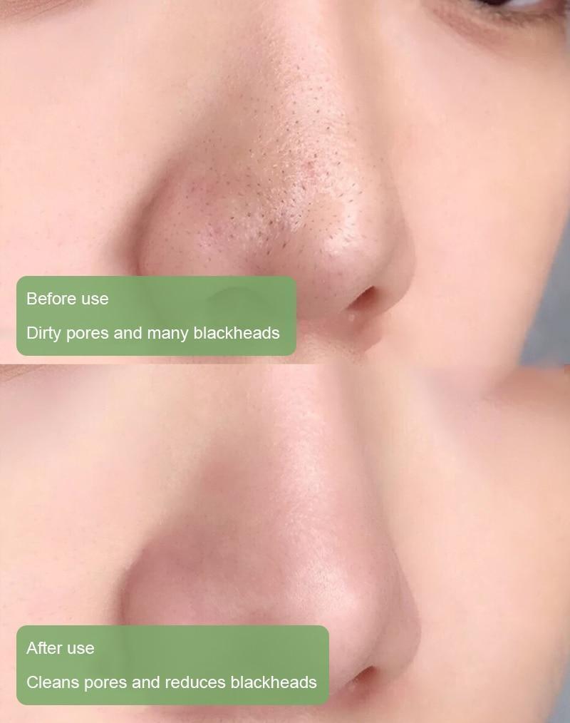 Diystar™ Green Tea Deep Cleanse Mask Stick