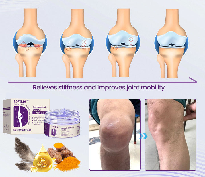 šæLOVILDS⢠Curcumin & Emu Oil Pain Gel ā š„Backed by US Osteopathic Experts