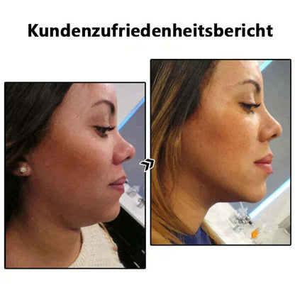 🔥 (LETZTER TAG VERKAUF - 70 % RABATT) Histone™ Lymphatic MagneTherapie Germanium Ohrringe
