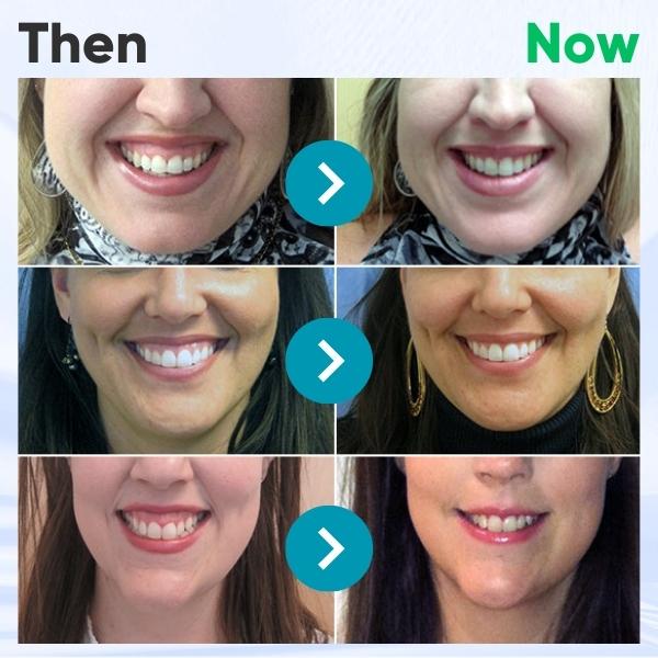 (🔥LAST DAY SALE-80% OFF) LOVILDS™ Gum Therapy Gel