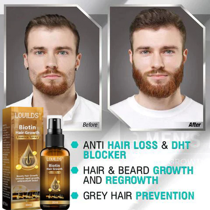 （🔥LAST DAY SALE-50% OFF)  Lovilds™ Premium Hair Growth Serum✨