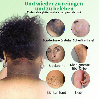 Histone™ Reinigendes Peeling-Gel🍇- für Acanthosis Nigricans, Peeling, dunkle Flecken, Hautflecken und Ekzeme