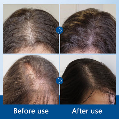 🔥🔥🔥LOVILDS^TM Ice-Roll Hair Activating Serum(🎁Flash Sale - Don’t Miss Out)