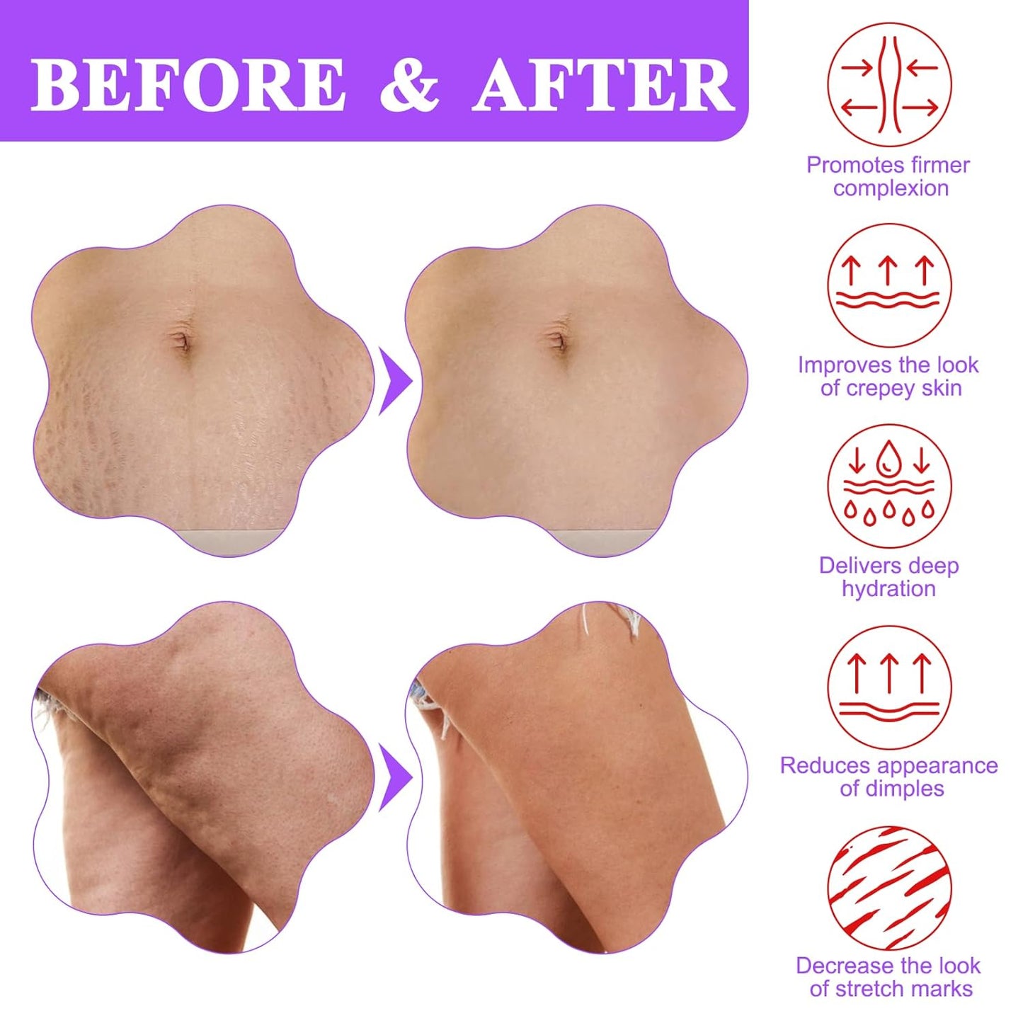 BBOJI™ Tighten & Smooth Belly Firming Cream