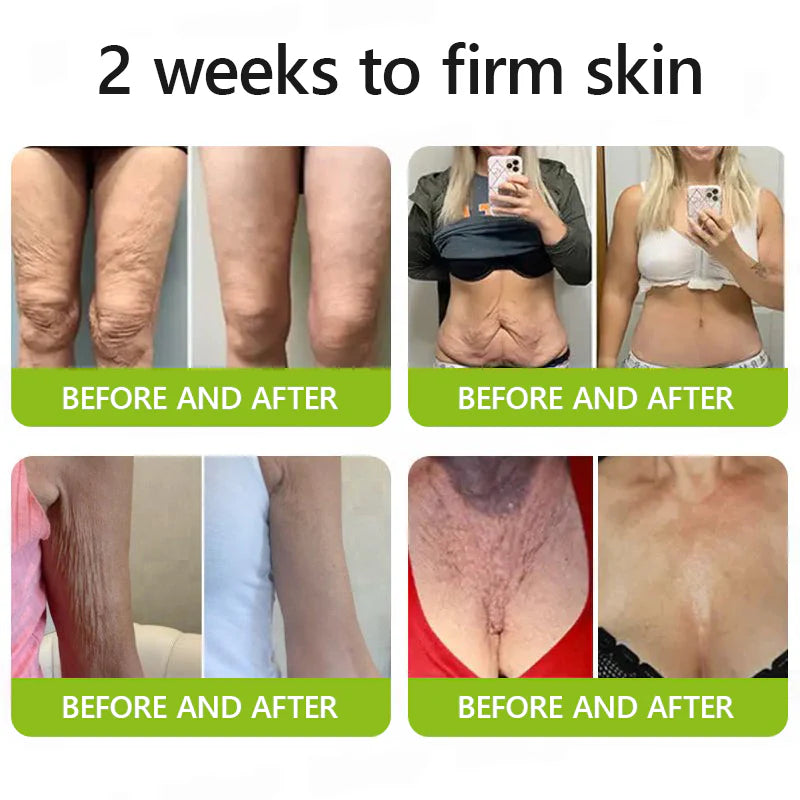 🔥Last 3 Hours! 70% OFF:Cougex™ Retinal Shot Tightening Booster- Eraser for Deep Wrinkles, Sagging Jowls & Puffy Eyes