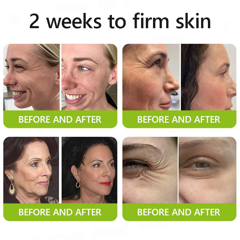 🔥Last 3 Hours! 70% OFF:Cougex™ Retinal Shot Tightening Booster- Eraser for Deep Wrinkles, Sagging Jowls & Puffy Eyes