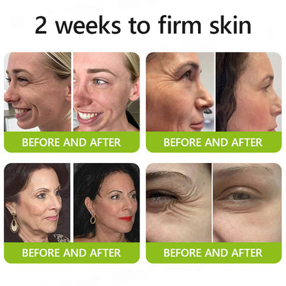 🔥Last 3 Hours! 70% OFF:Cougex™ Retinal Shot Tightening Booster- Eraser for Deep Wrinkles, Sagging Jowls & Puffy Eyes