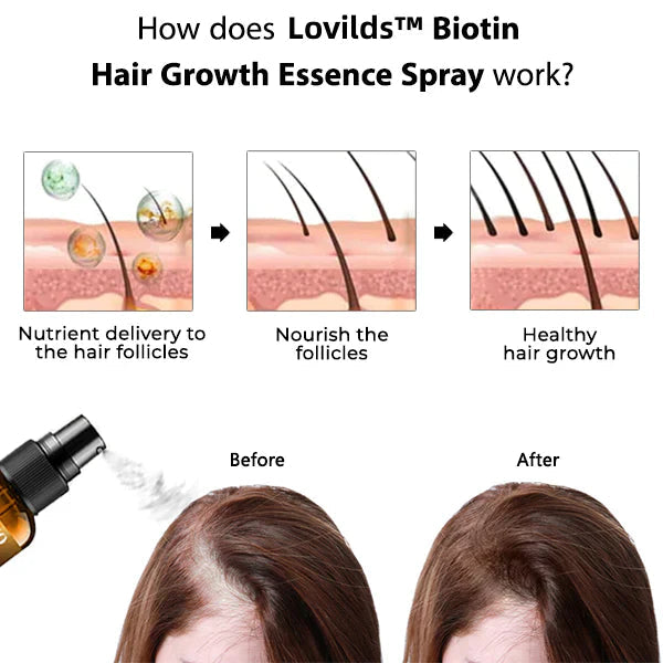 （🔥LAST DAY SALE-50% OFF)  Lovilds™ Premium Hair Growth Serum✨