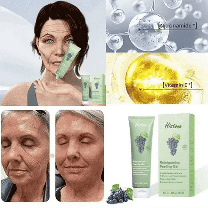 Histone™ Reinigendes Peeling-Gel🍇- für Acanthosis Nigricans, Peeling, dunkle Flecken, Hautflecken und Ekzeme