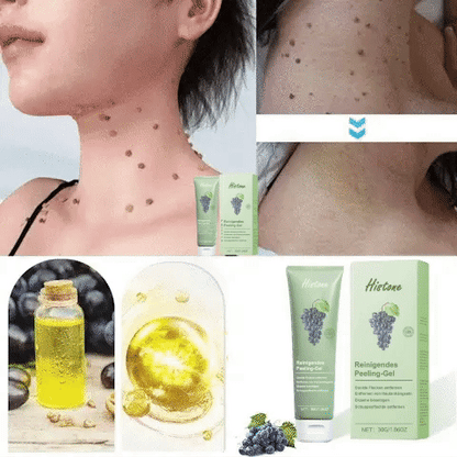 Histone™ Reinigendes Peeling-Gel🍇- für Acanthosis Nigricans, Peeling, dunkle Flecken, Hautflecken und Ekzeme